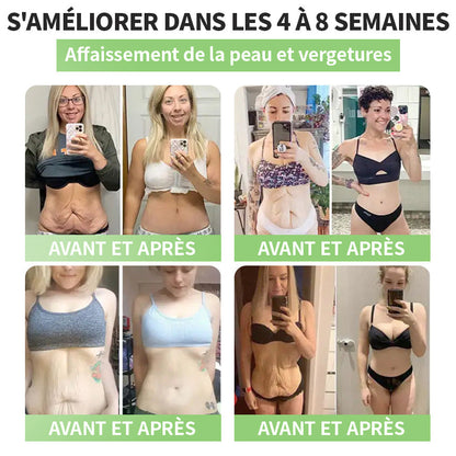 Plus que 10 boîtes ! 🌟 Profitez de -30% sur les patchs HHVB® — testés et approuvés par des médecins. 4 à 6 boîtes suffisent pour gérer le poids et la glycémie durablement. Ne ratez pas cette offre !