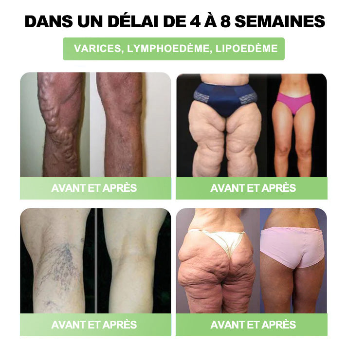 Plus que 10 boîtes ! 🌟 Profitez de -30% sur les patchs HHVB® — testés et approuvés par des médecins. 4 à 6 boîtes suffisent pour gérer le poids et la glycémie durablement. Ne ratez pas cette offre !